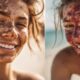 sunburn versus tan explained